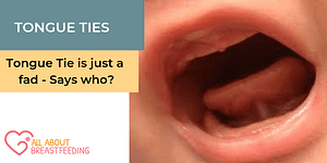 Tongue Tie is just a fad – Says who?